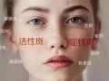 活斑最新爆料,揭秘神秘事件背后的惊人真相